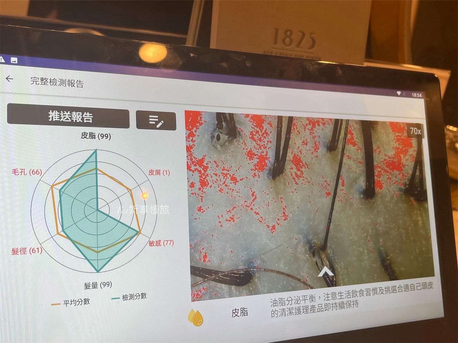 1825頭皮養護中心｜台北頭皮護理養護spa，頭皮感覺在呼吸、頭髮也更蓬鬆了！（含價目表）