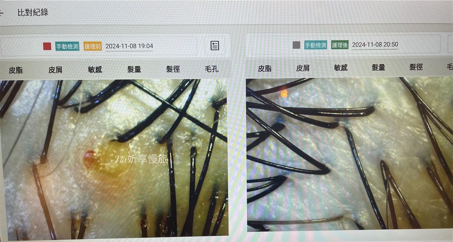 1825頭皮養護中心｜台北頭皮護理養護spa，頭皮感覺在呼吸、頭髮也更蓬鬆了！（含價目表）