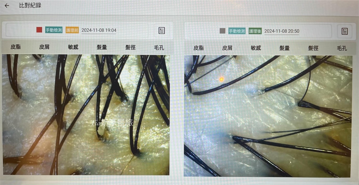 1825頭皮養護中心｜台北頭皮護理養護spa，頭皮感覺在呼吸、頭髮也更蓬鬆了！（含價目表）