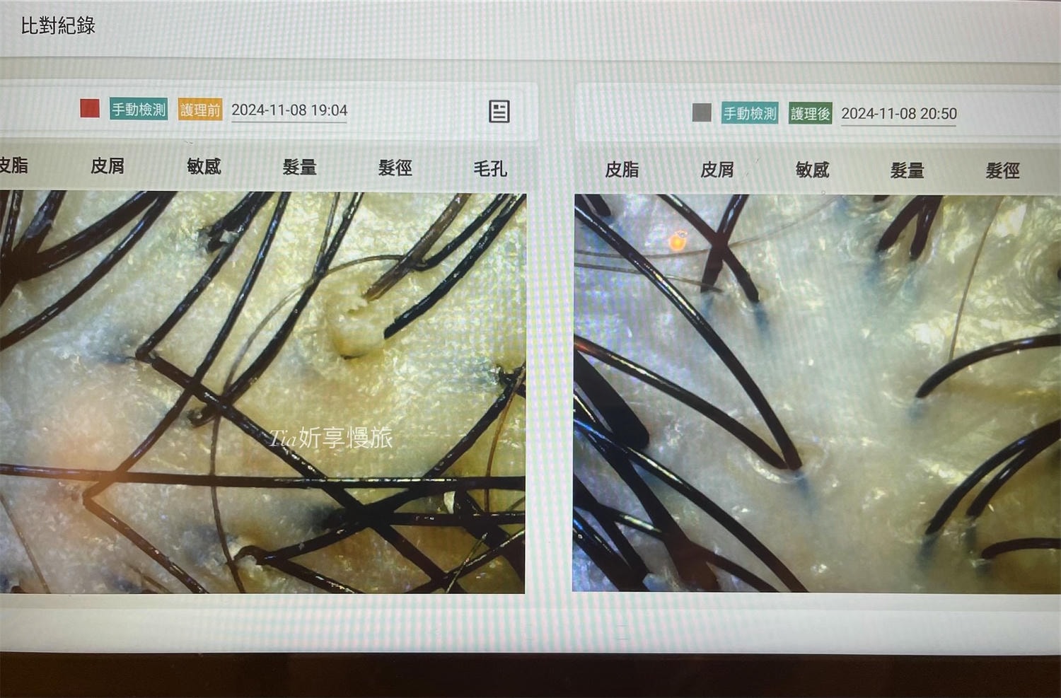 1825頭皮養護中心｜台北頭皮護理養護spa，頭皮感覺在呼吸、頭髮也更蓬鬆了！（含價目表）