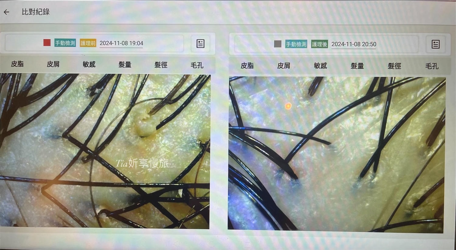 1825頭皮養護中心｜台北頭皮護理養護spa，頭皮感覺在呼吸、頭髮也更蓬鬆了！（含價目表）