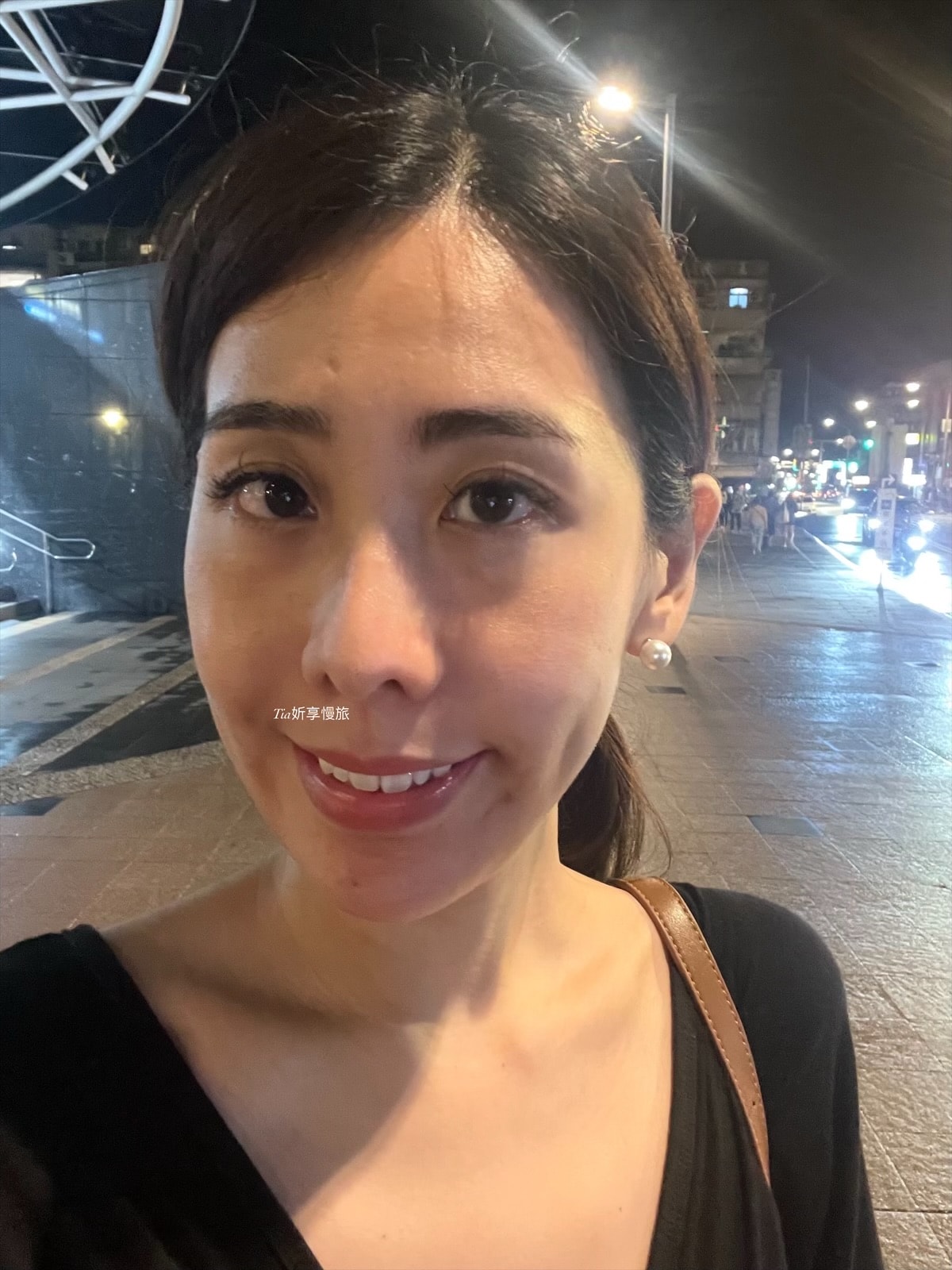 台北彥靚診所|法令紋、淚溝、下巴、太陽穴玻尿酸評價分享 - 第7張圖 台北彥靚診所|法令紋、淚溝、下巴、太陽穴玻尿酸評價分享