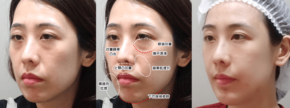 這張圖片的 alt 屬性值為空，它的檔案名稱為 image10-1.png