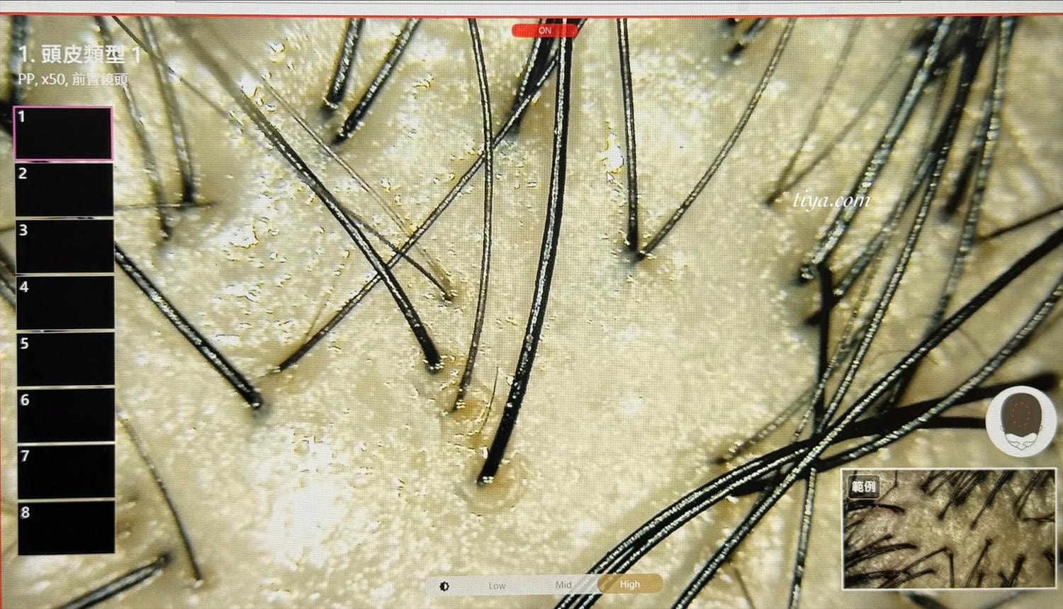 台北頭皮養護｜1825雅諾絲頭皮養護中心圓山店，頭皮養護療程護髮推薦