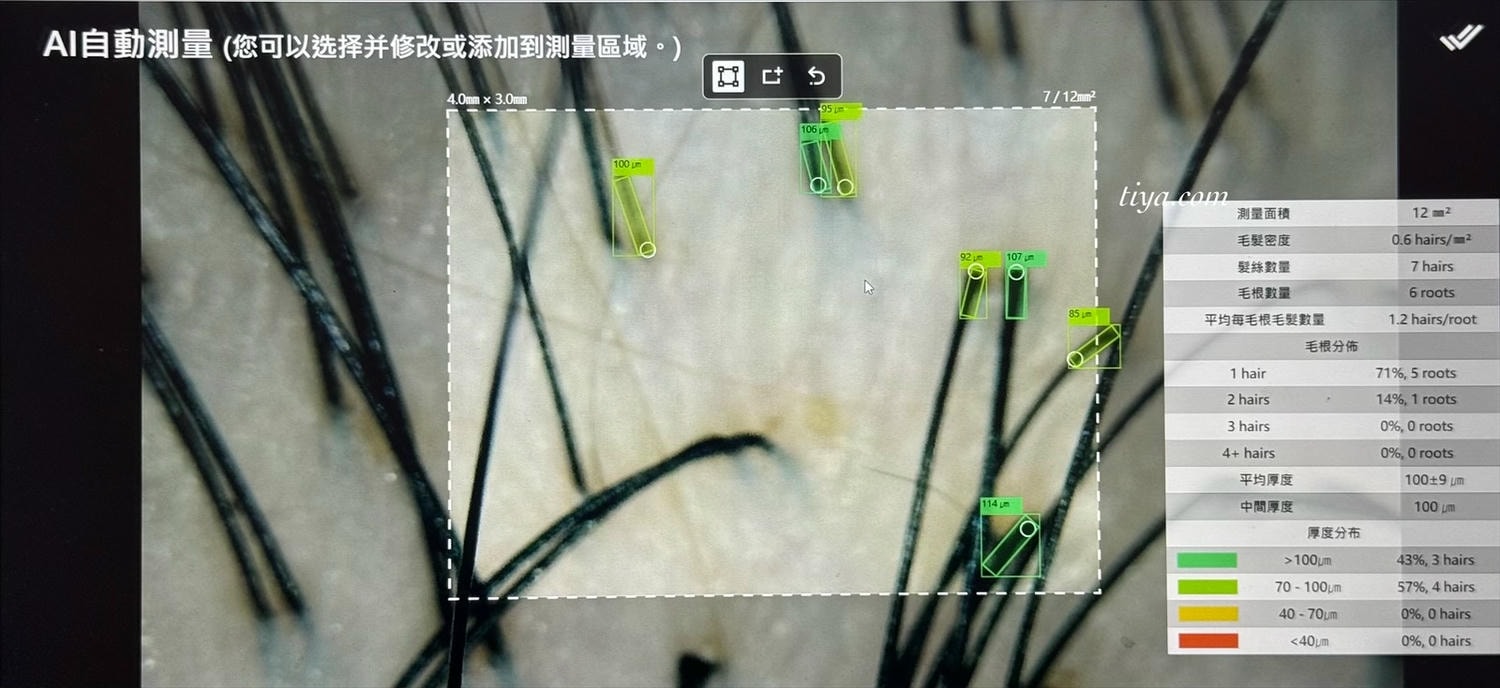 台北頭皮養護｜1825雅諾絲頭皮養護中心圓山店，頭皮養護療程護髮推薦