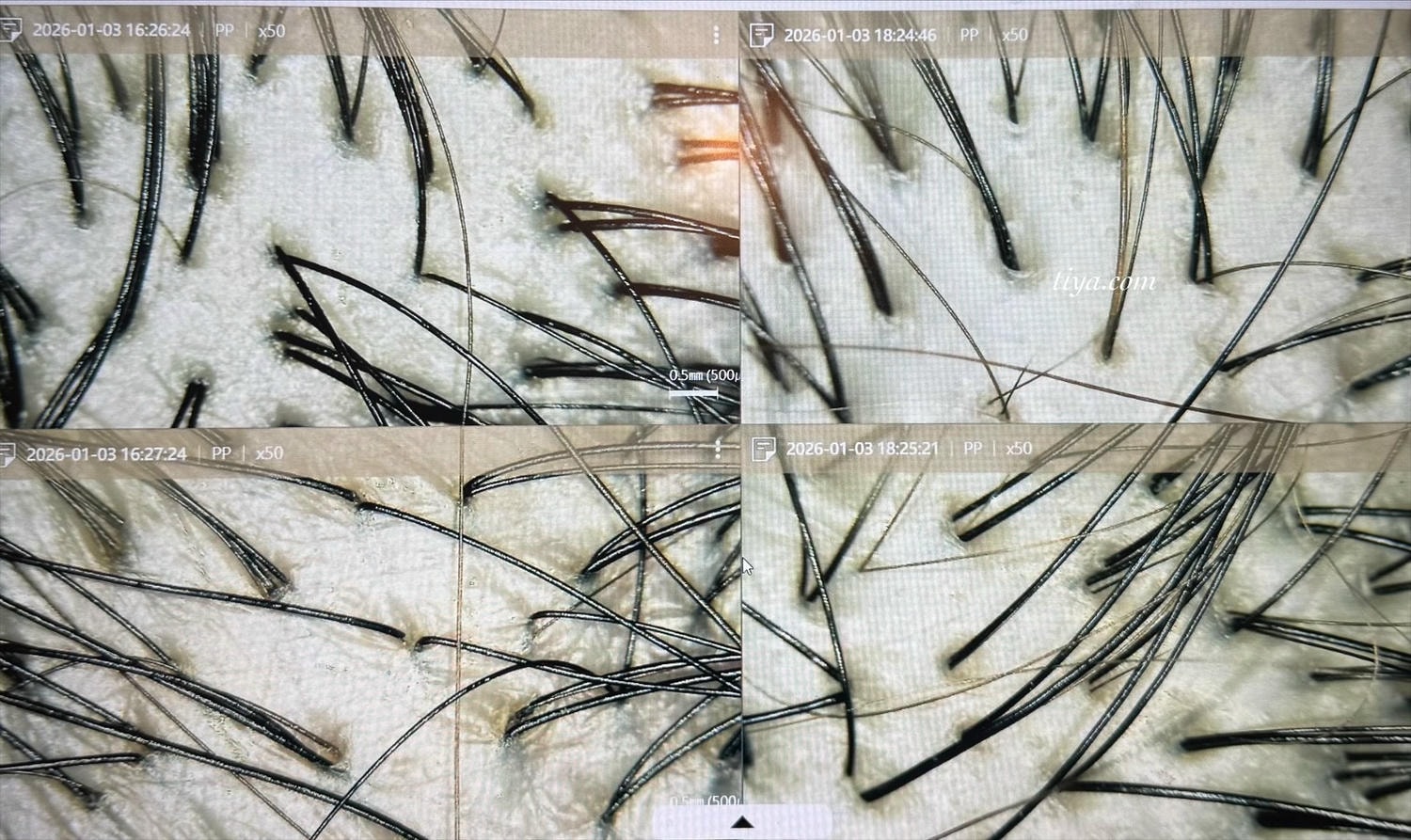 台北頭皮養護｜1825雅諾絲頭皮養護中心圓山店，頭皮養護療程護髮推薦